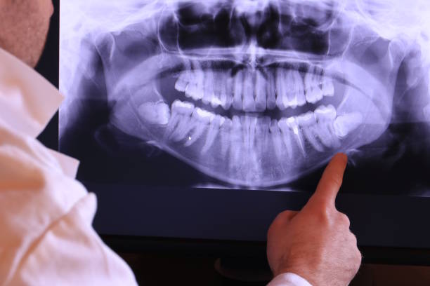 Best Emergency Denture Repair in Las Vegas, NV