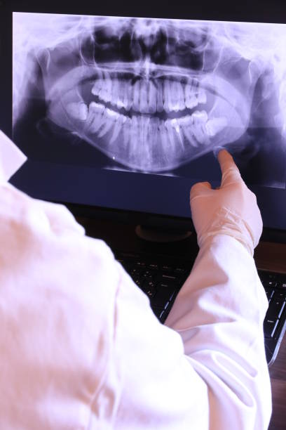 Best Broken or Chipped Tooth Repair in Las Vegas, NV