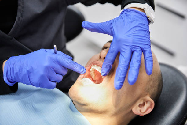Best Knocked-Out Tooth (Avulsed Tooth) Treatment in Las Vegas, NV